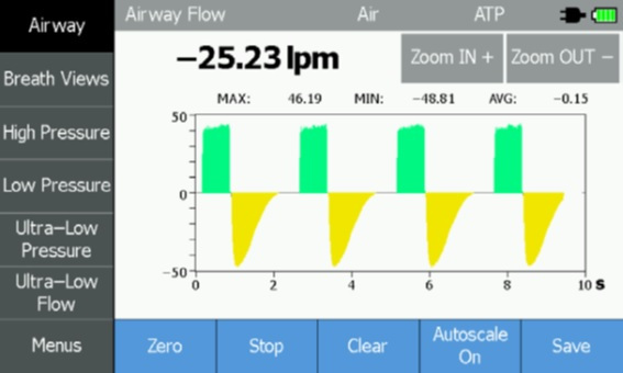 Figura 1. Gráfico de flujo de vía aérea de un ventilador típico