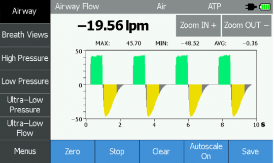 Figura 3. Gráfico de vía aérea de un ventilador con umbrales de trigger de flujo ajustados a 30 litros por minuto