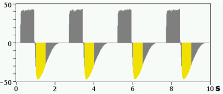 Figura 4. Gráfico de vía aérea con umbral de trigger de flujo demasiado alto en inspiración